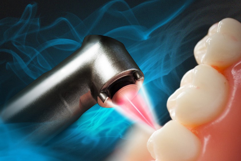 zdjęcie: Fotona LightWalker® dental laser